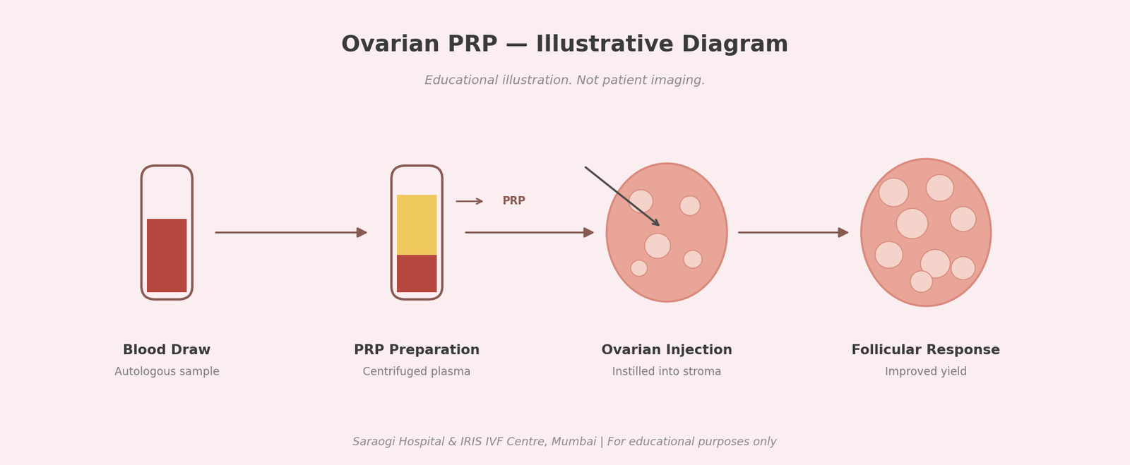 Educational diagram showing PRP preparation and ovarian injection process: blood draw, PRP, ovarian injection, and follicular response stages.