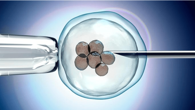 IMSI (Intracytoplasmic Morphologically Selected Sperm Injection)