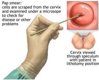 oncology