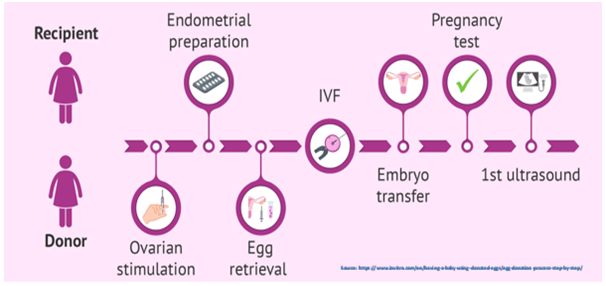 steps of IVF using a donor egg