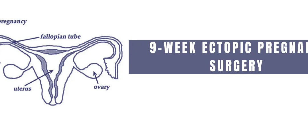 9-Week Ectopic Pregnancy Surgery