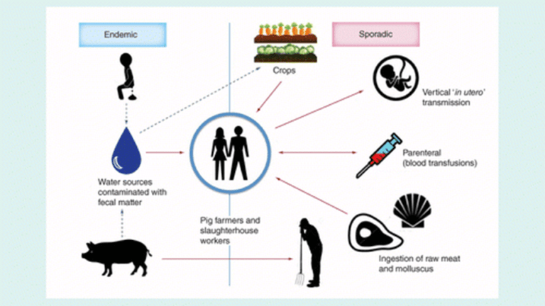 causes of hepatitis