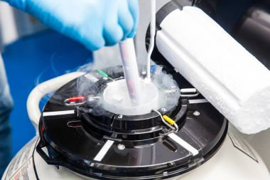 Frozen Embryo Transfer (FET)