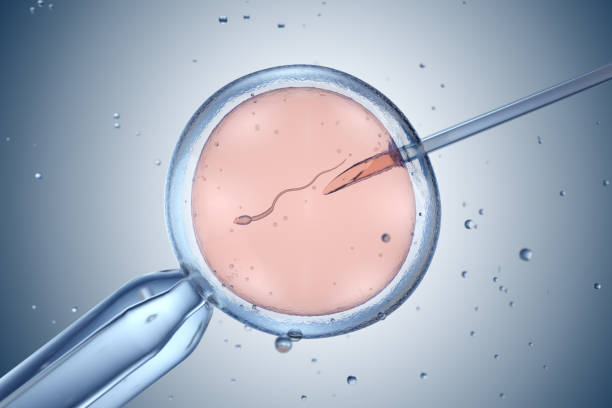 ICSI (Intracytoplasmic Sperm Injection)