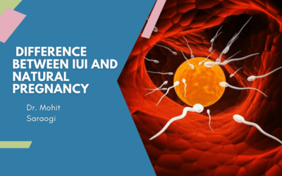 What Is the Difference Between IUI and Natural Pregnancy?