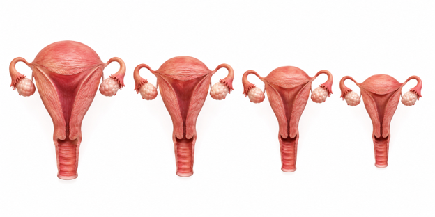 Four uteruses lined up side by side, showing the uterus and fallopian tubes in a row.