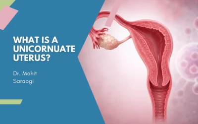 What Is a Unicornuate Uterus?