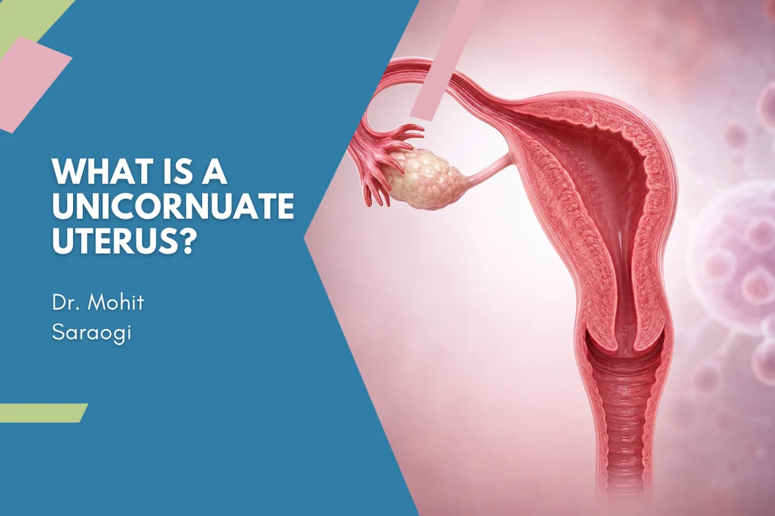 What Is a Unicornuate Uterus?