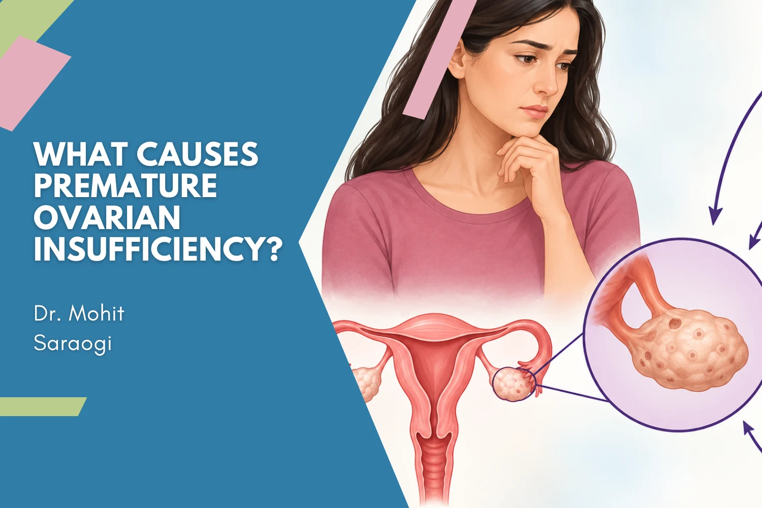 What Causes Premature Ovarian Insufficiency?