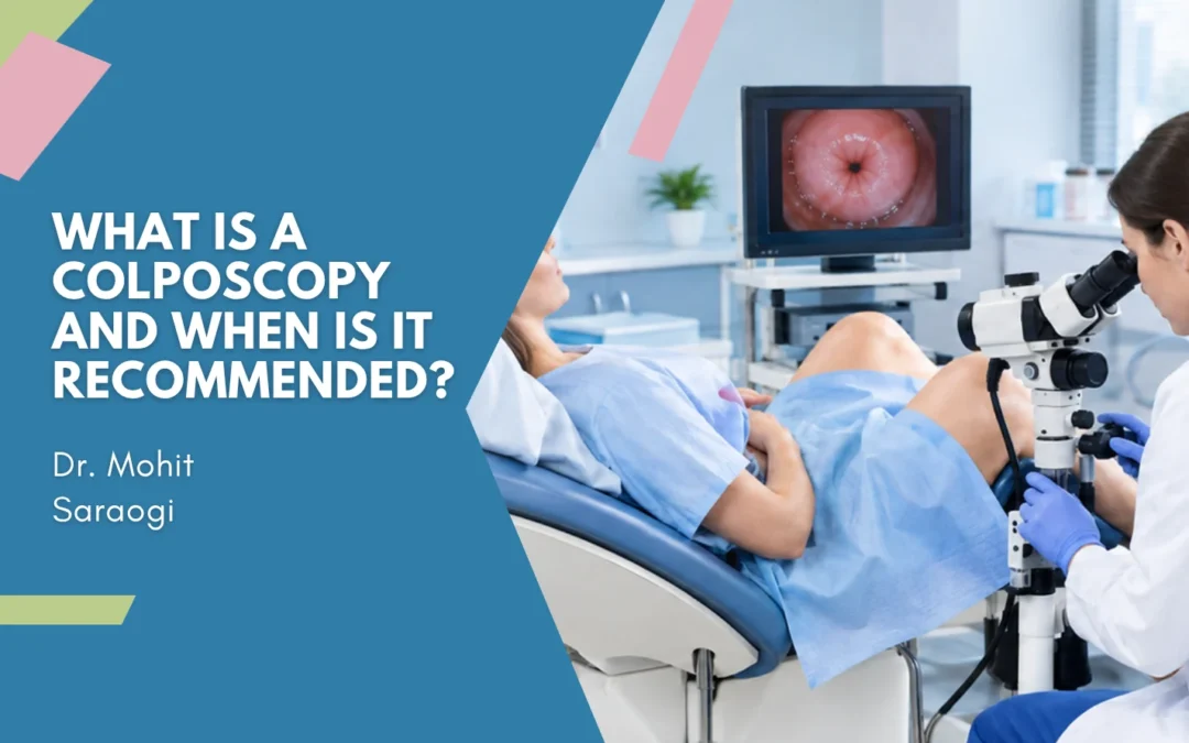 What Is a Colposcopy and When Is It Recommended?