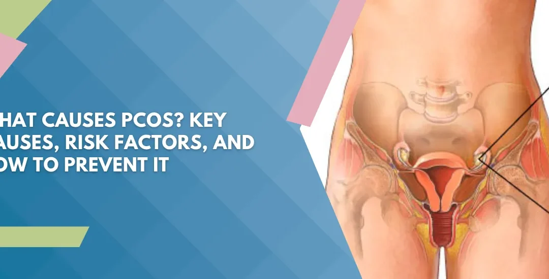 Educational banner about PCOS causes and prevention with a blue geometric background and a medical diagram of the female reproductive system on the right.