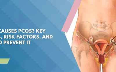 What Causes PCOS? Key Causes, Risk Factors, and How to Prevent It