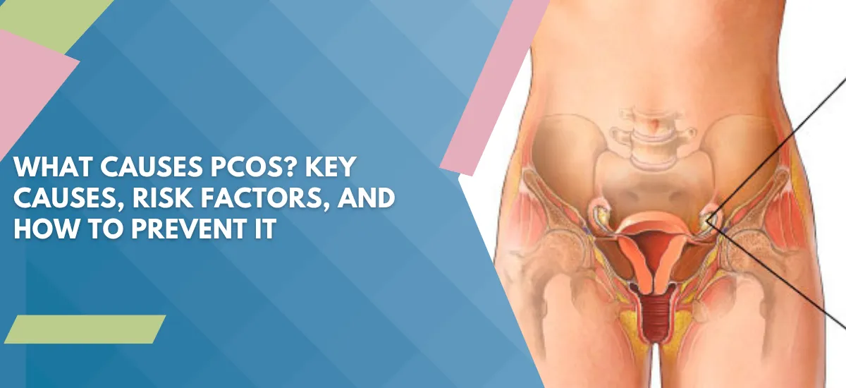 image2 - Saraogi Hospital Educational banner about PCOS causes and prevention with a blue geometric background and a medical diagram of the female reproductive system on the right.
